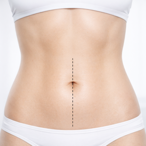 Bauchnabellinie